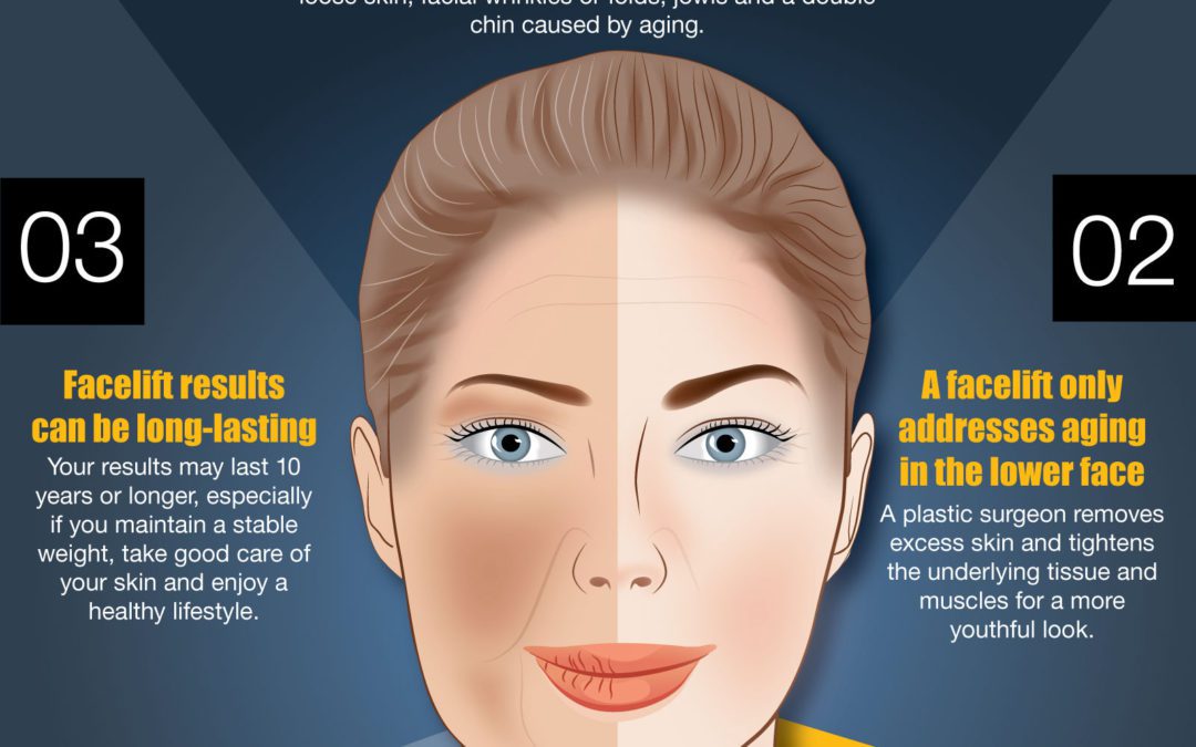 5 Things You Should Know about Facelifts [Infographic]