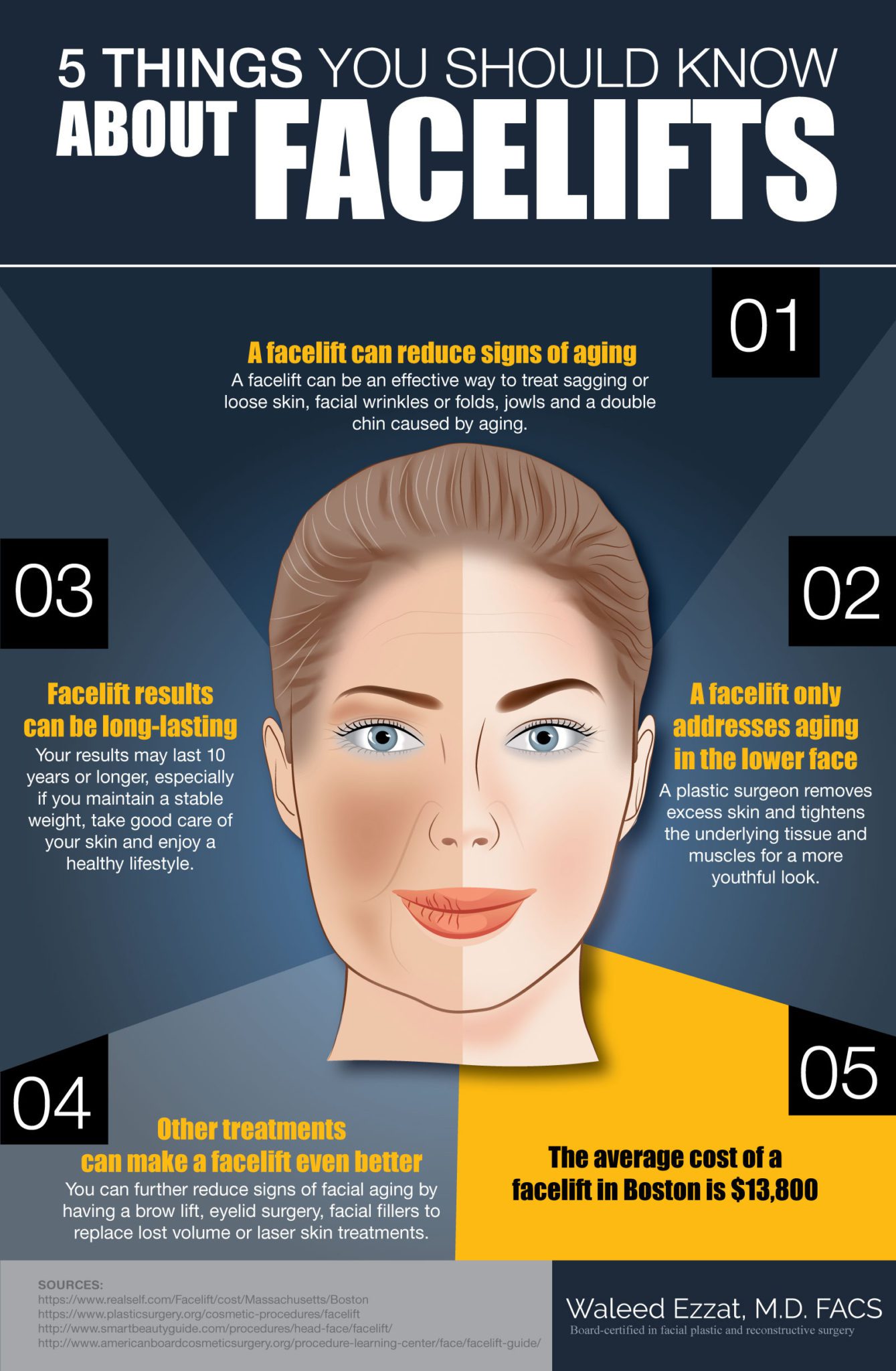 facelift infographic