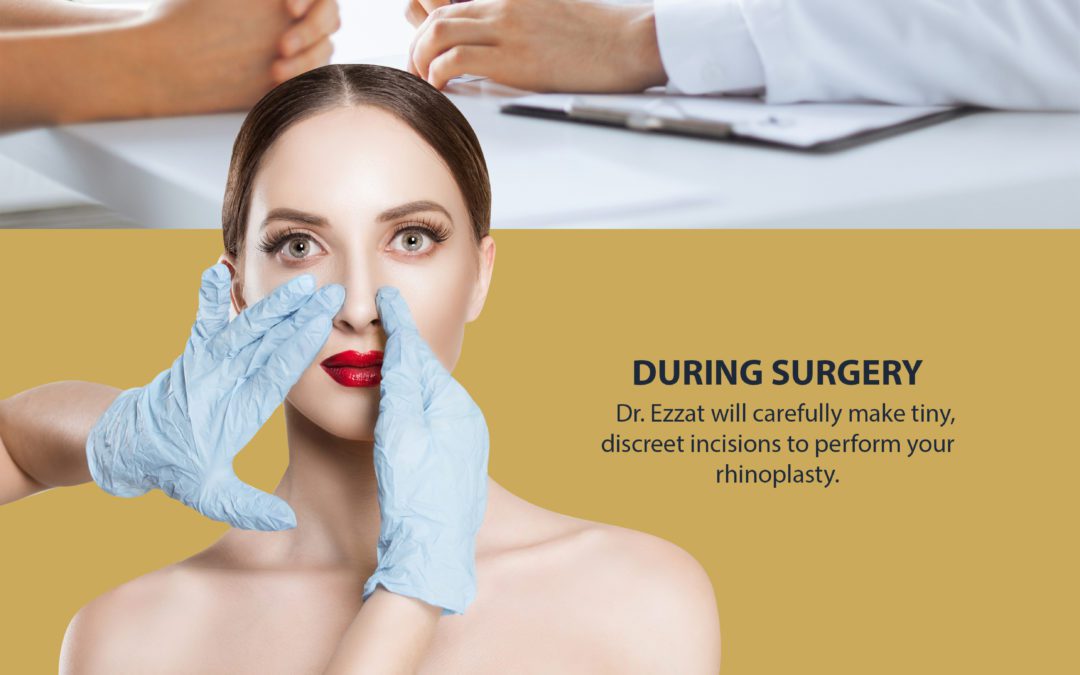Your Guide To Each Stage of Having Nose Surgery [Infographic]