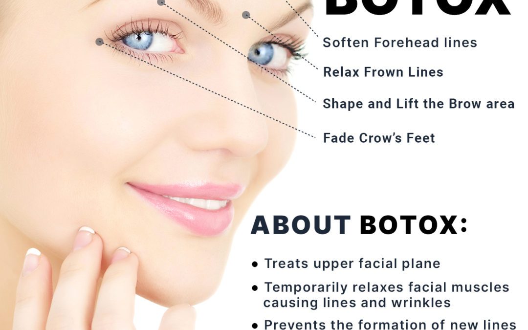 The Benefits of Botox [Infographic]