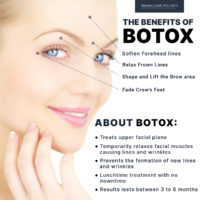 The Benefits of Botox [Infographic]