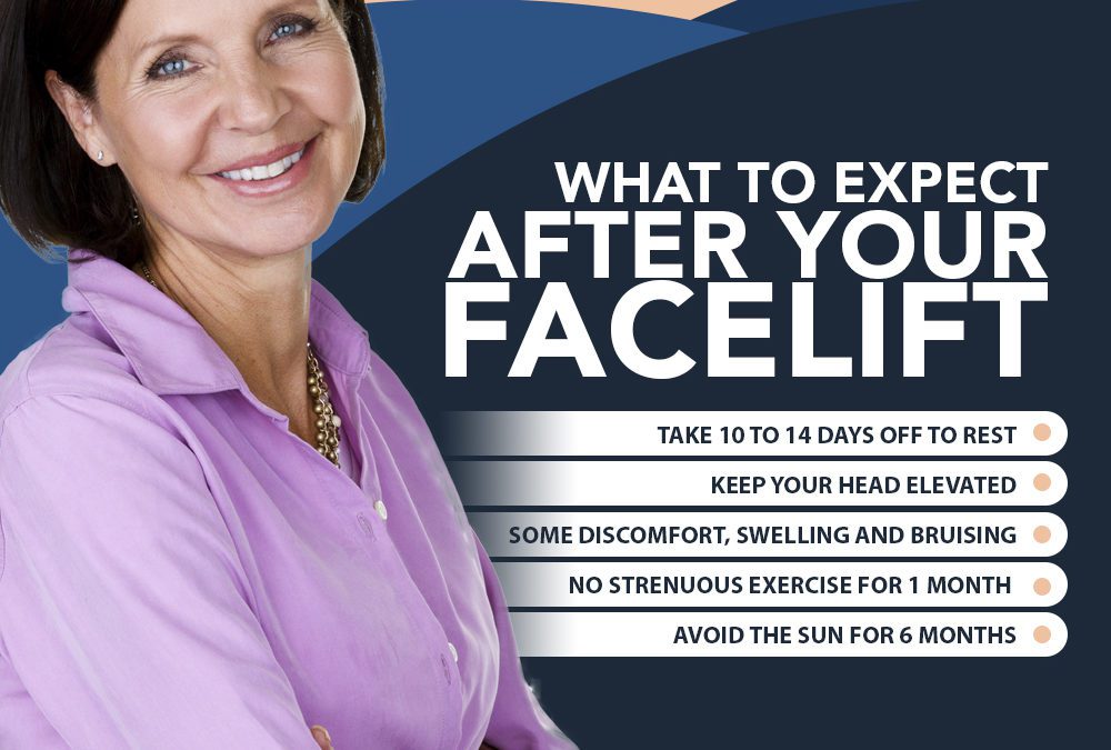 What To Expect After Your Facelift [Infographic]