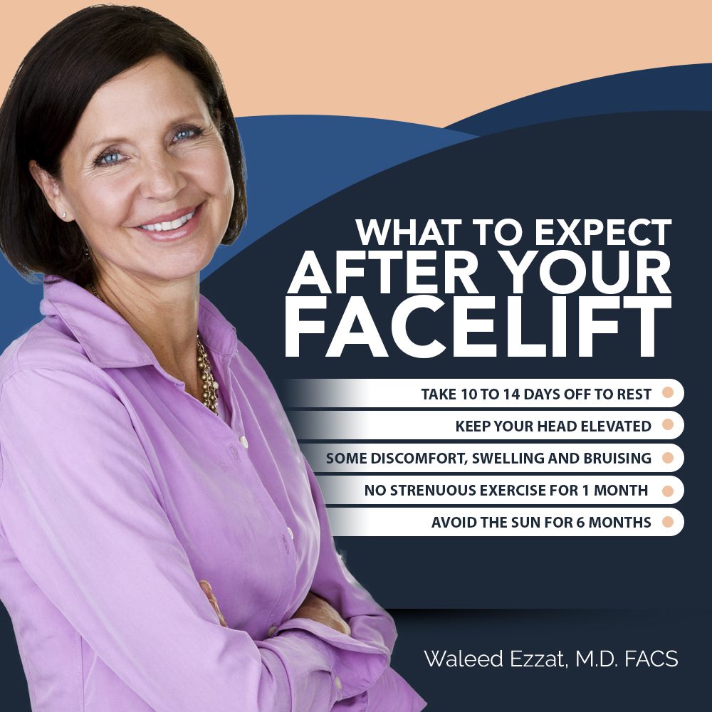 What To Expect After Your Facelift [Infographic] img 1