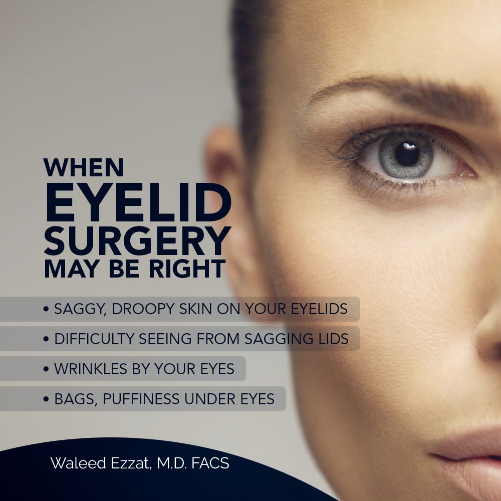 When Eyelid Surgery May Be Right [Infographic] img 1