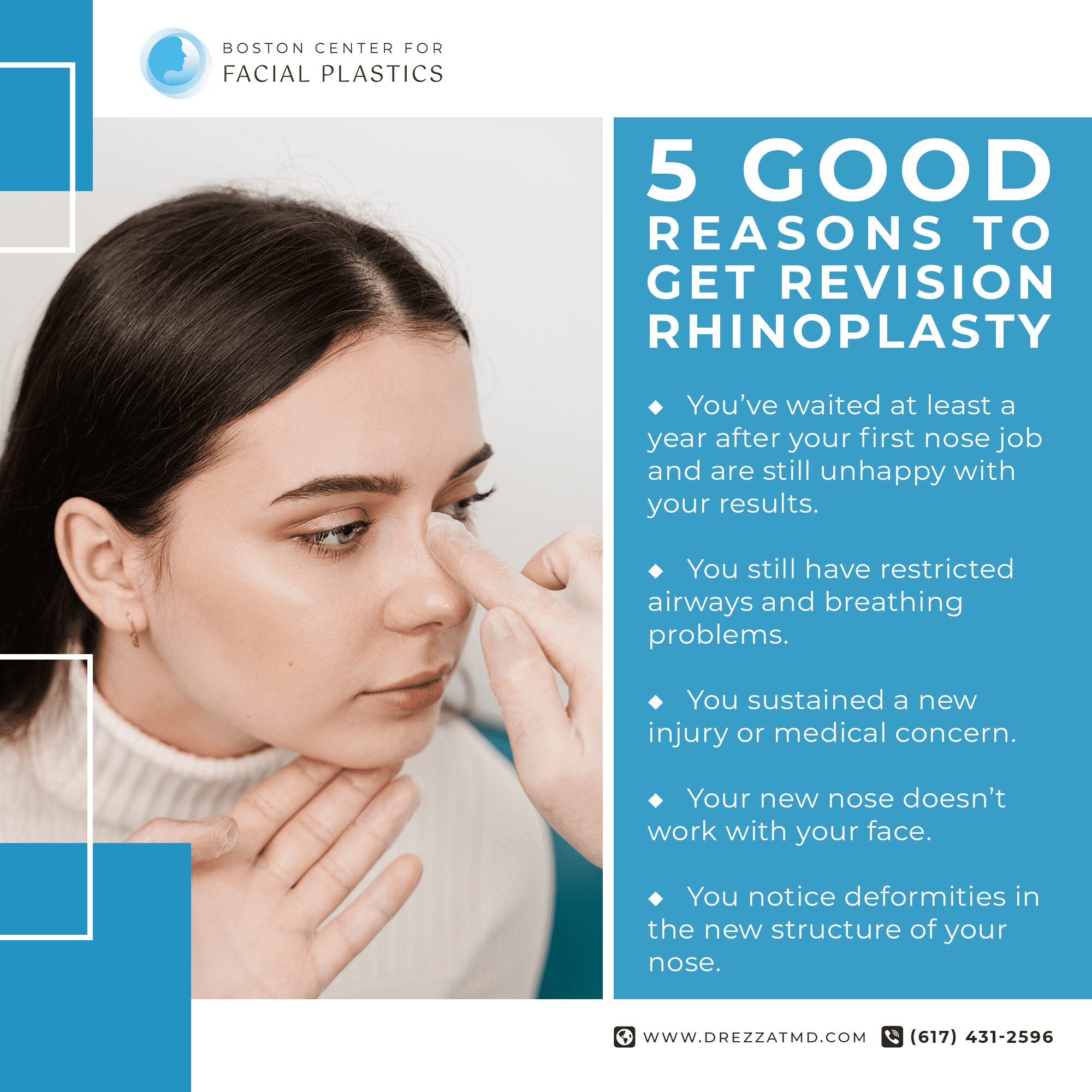 5 Good Reasons to Get Revision Rhinoplasty