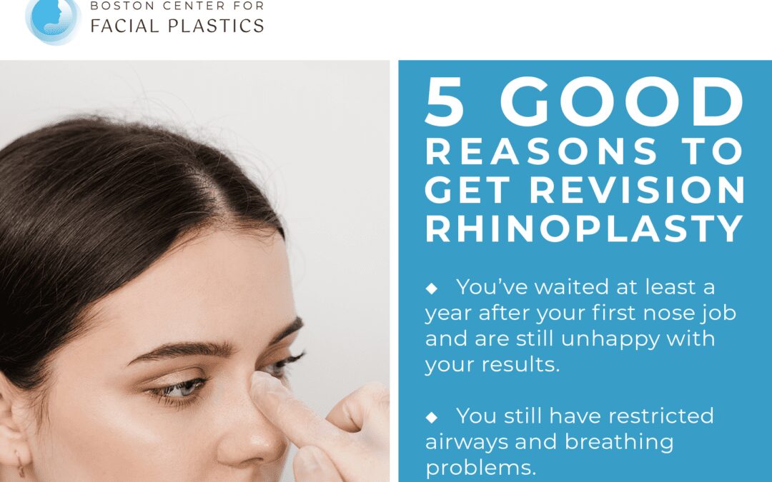 5 Good Reasons to Get Revision Rhinoplasty thumb