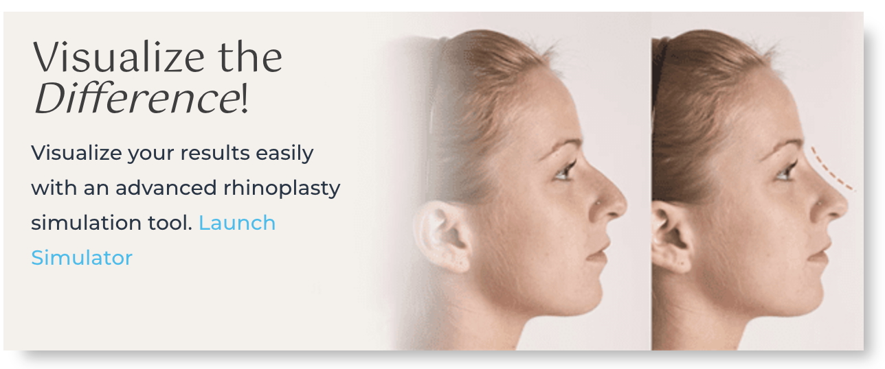 Side-by-side images of a woman’s nose before and after her rhinoplasty nose surgery in Boston, with the text overlay: “Visualize the Difference! Visualize your results easily with an advanced rhinoplasty simulation tool. Launch simulator.”